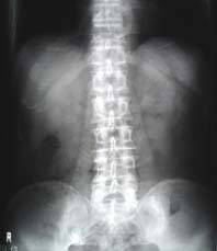 abdomen.jpg (4909 oCg)