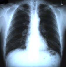 chest.jpg (6561 oCg)