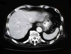 ct_image1.jpg (6398 oCg)