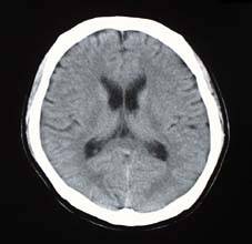 ct_image2.jpg (7271 oCg)