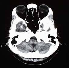 ct_image3.jpg (8222 oCg)