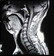 mri_image.jpg (11163 oCg)