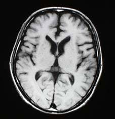 mri_image2.jpg (8331 oCg)
