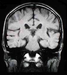 mri_image3.jpg (9846 oCg)