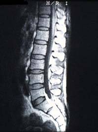 mri_image4.jpg (7520 oCg)