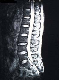 mri_image5.jpg (8718 oCg)
