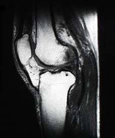 mri_image6.jpg (7373 oCg)