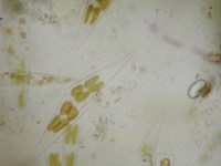 植物プランクトンの一種