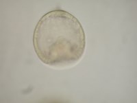 原腸胚前期