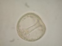 原腸胚後期