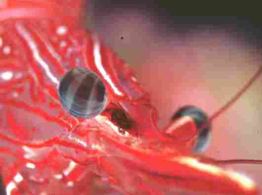 ��޸�׻���